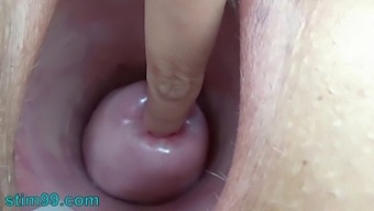 Bizarre Extreme: A Woman Inserts Nettles And Rod Flowers Into Her Vagina
